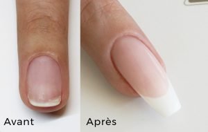 Supreme French Avant après